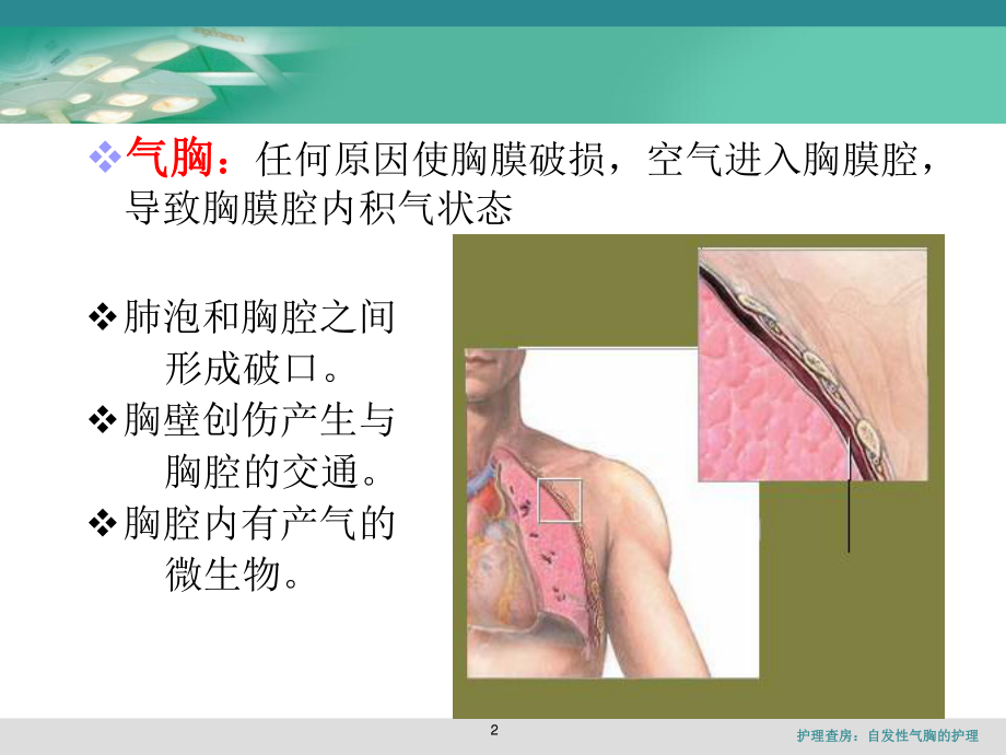 护理查房：自发性气胸的护理课件.ppt_第2页