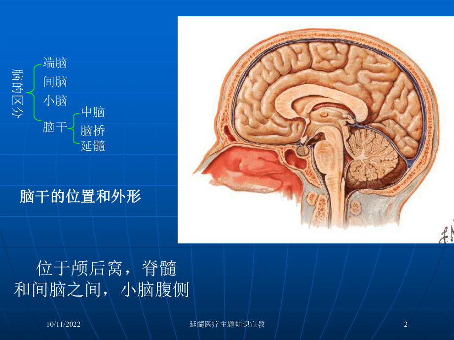 延髓医疗主题知识宣教课件.ppt_第2页