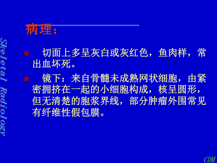 尤文肉瘤影像诊断课件.ppt_第3页