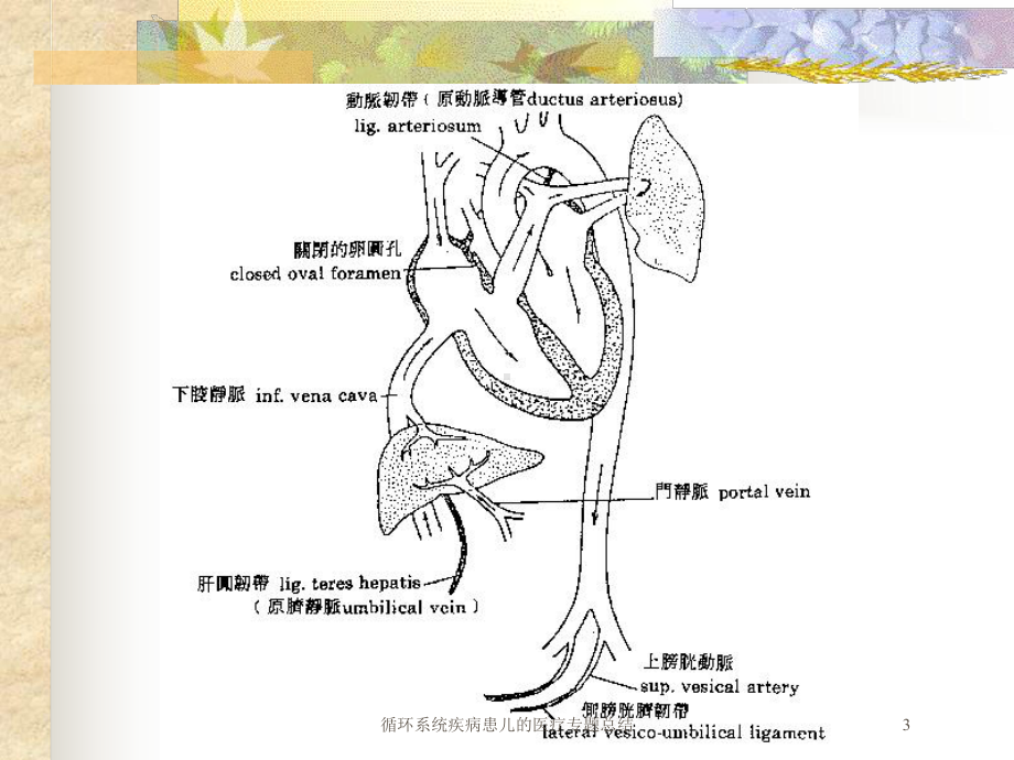 循环系统疾病患儿的医疗专题总结培训课件.ppt_第3页