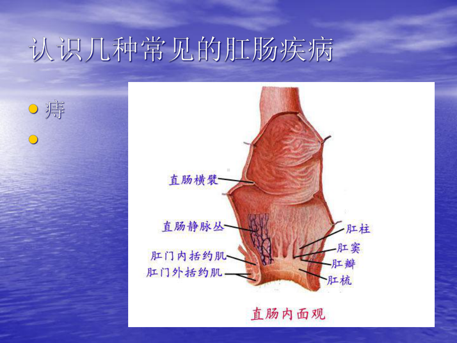 常见肛肠疾病诊疗与预防课件.ppt_第2页