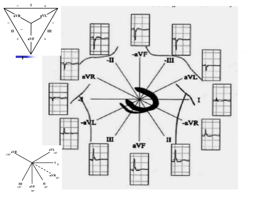 心电图aVR导联新价值课件.ppt_第2页