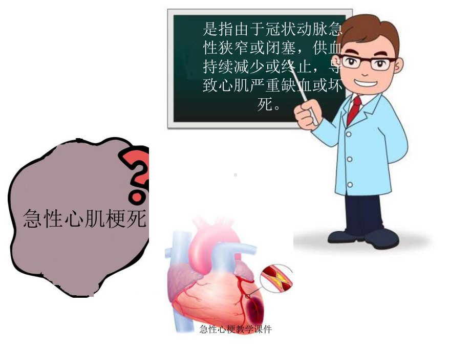 急性心梗教学课件.ppt_第3页