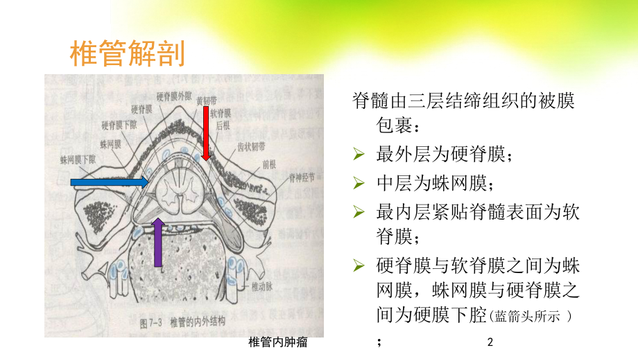 椎管内肿瘤培训课件.ppt_第2页