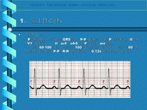 心律失常的识别和处置课件.ppt