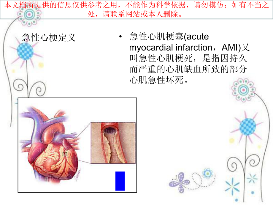 急性心梗急诊行PCI术中配合培训课件.ppt_第1页