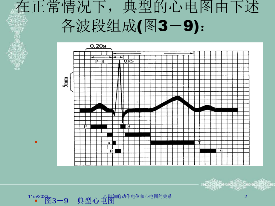 心肌细胞动作电位和心电图的关系培训课件.ppt_第2页