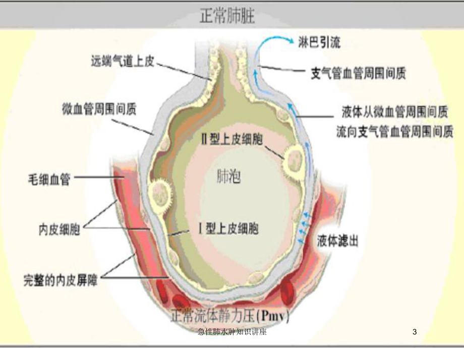 急性肺水肿知识讲座培训课件.ppt_第3页