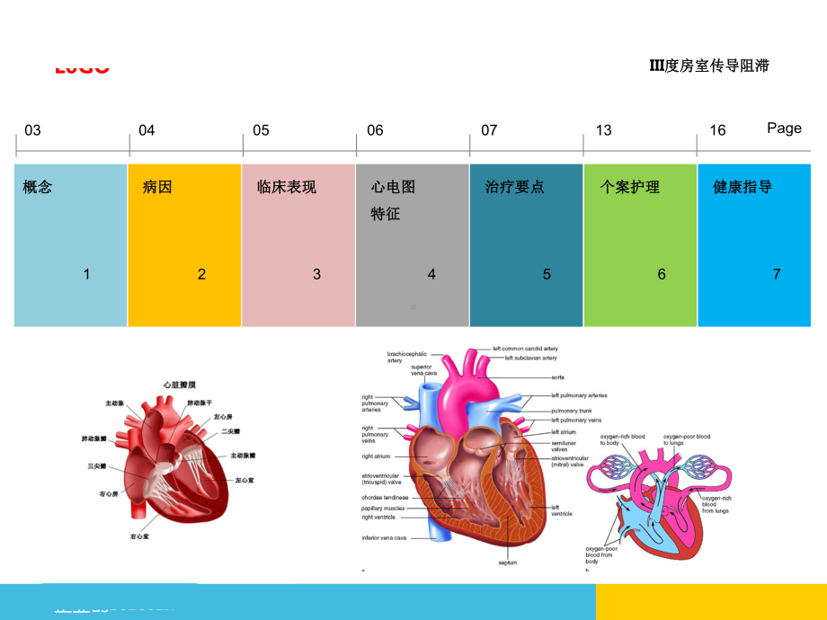 心内房室传导阻滞的护理查房朱琳课件.ppt_第2页