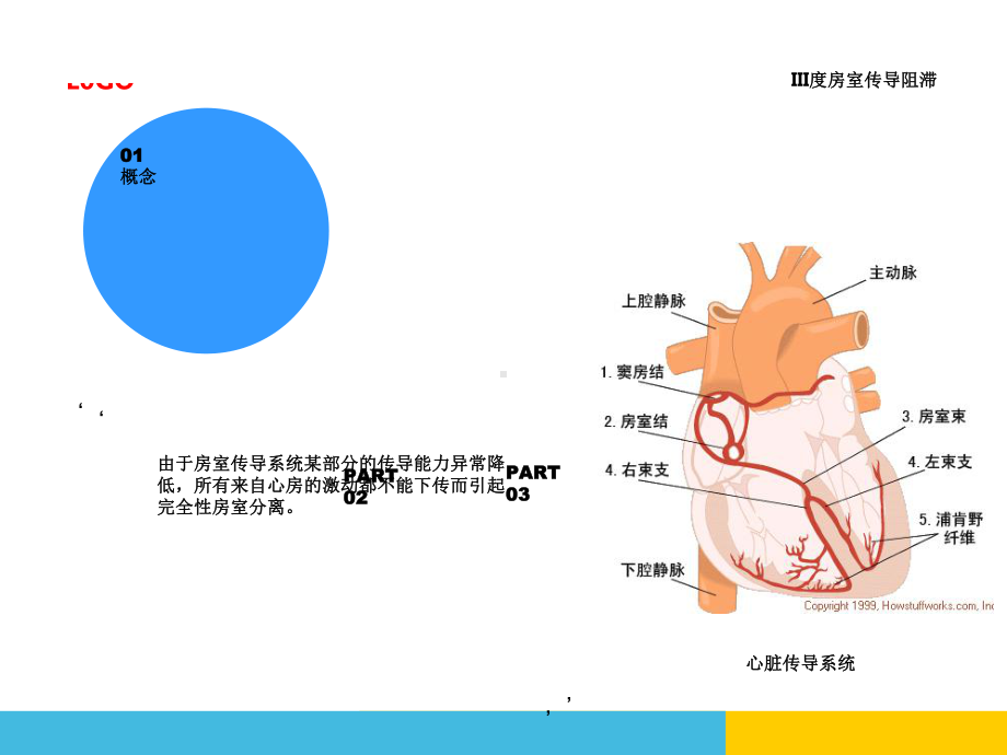 心内房室传导阻滞的护理查房朱琳课件.ppt_第3页