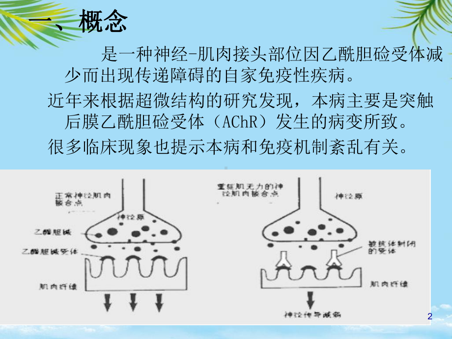 教培用重症肌无力的护理课件.ppt_第2页