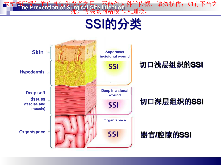 手术部位感染预防和控制培训课件.ppt_第3页