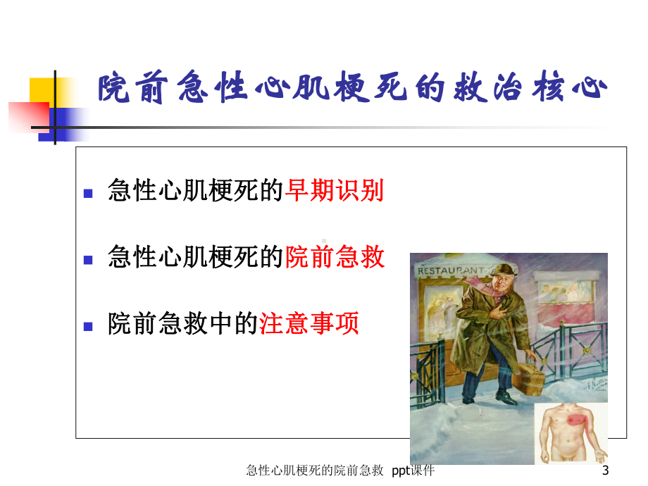 急性心肌梗死的院前急救-课件.ppt_第3页