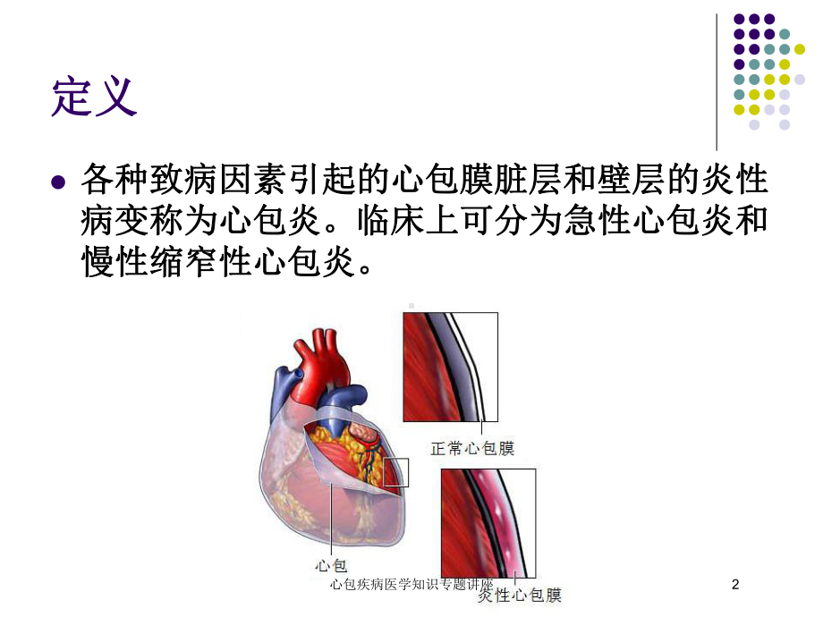 心包疾病医学知识专题讲座培训课件.ppt_第2页