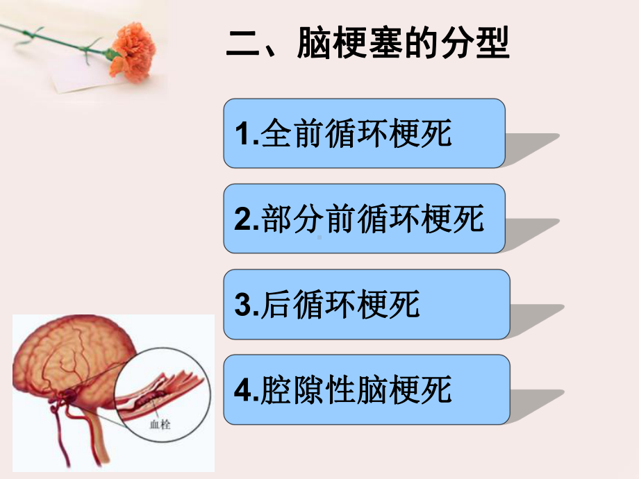 急性脑梗塞溶栓治疗医疗护理培训课件.ppt_第2页