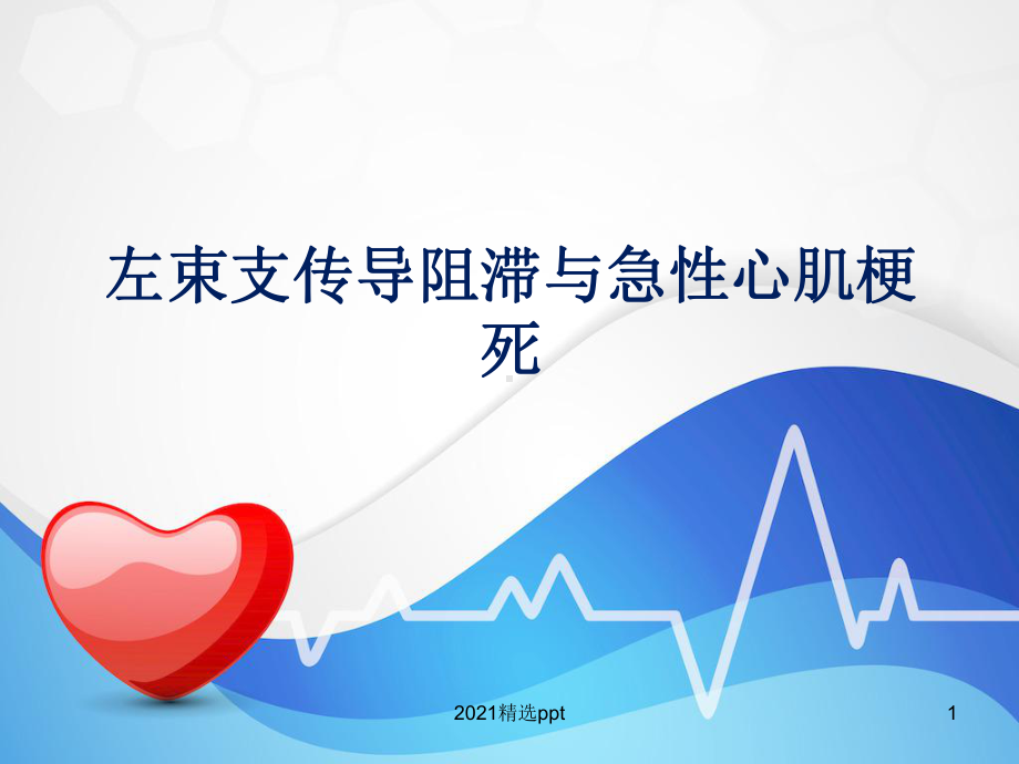 左束支传导阻滞与急性心肌梗死课件.ppt_第1页