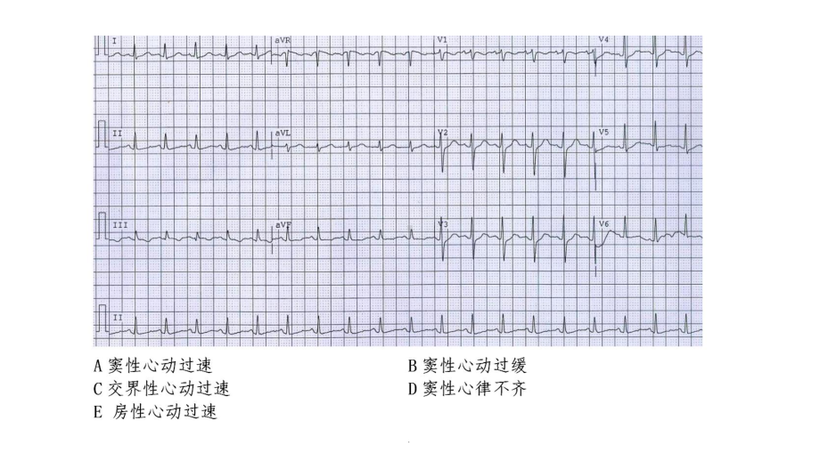 心电图练习题(带图有答案)课件.ppt_第1页