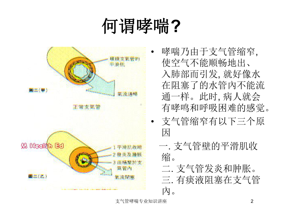 支气管哮喘专业知识讲座培训课件.ppt_第2页