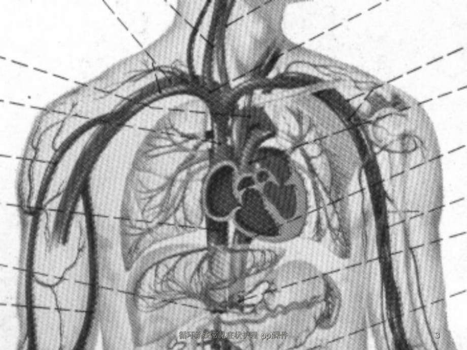 循环系统常见症状护理-课件.ppt_第3页