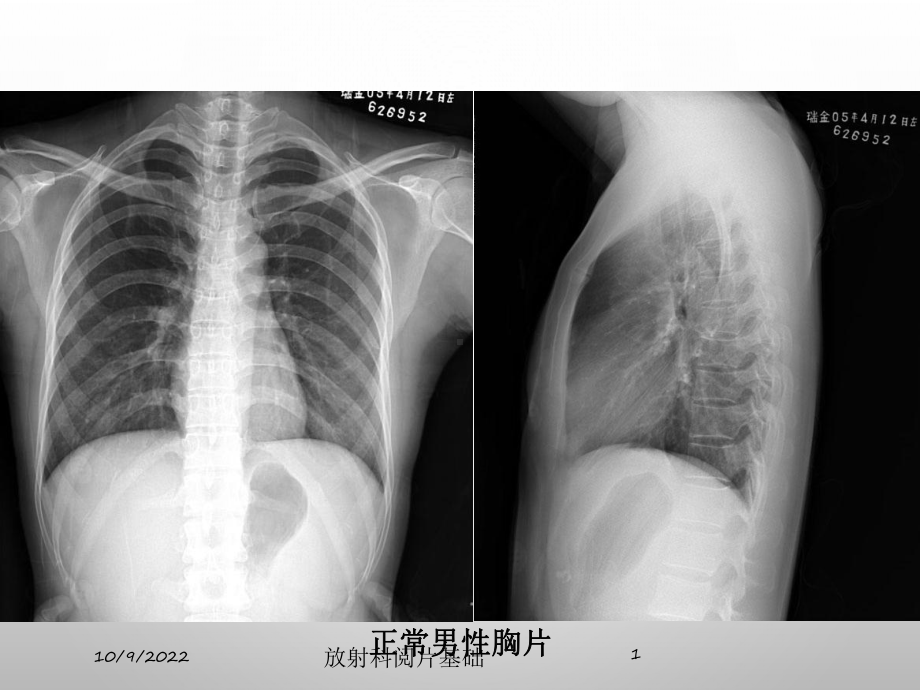 放射科阅片基础培训课件.ppt_第1页