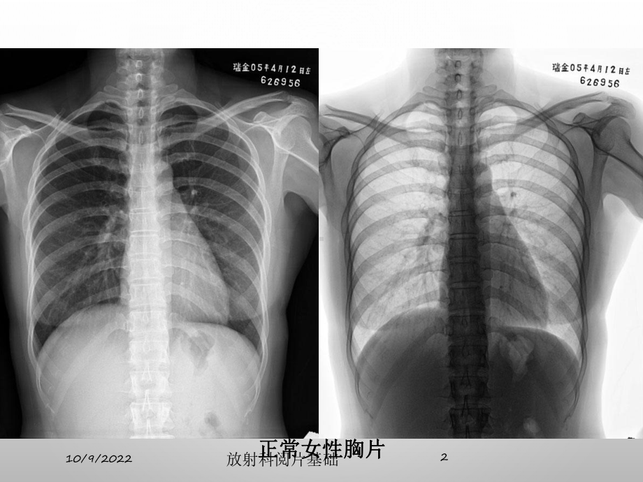 放射科阅片基础培训课件.ppt_第2页