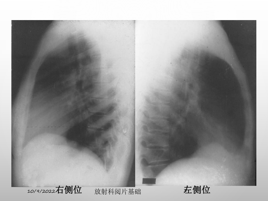 放射科阅片基础培训课件.ppt_第3页