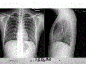 放射科阅片基础培训课件.ppt