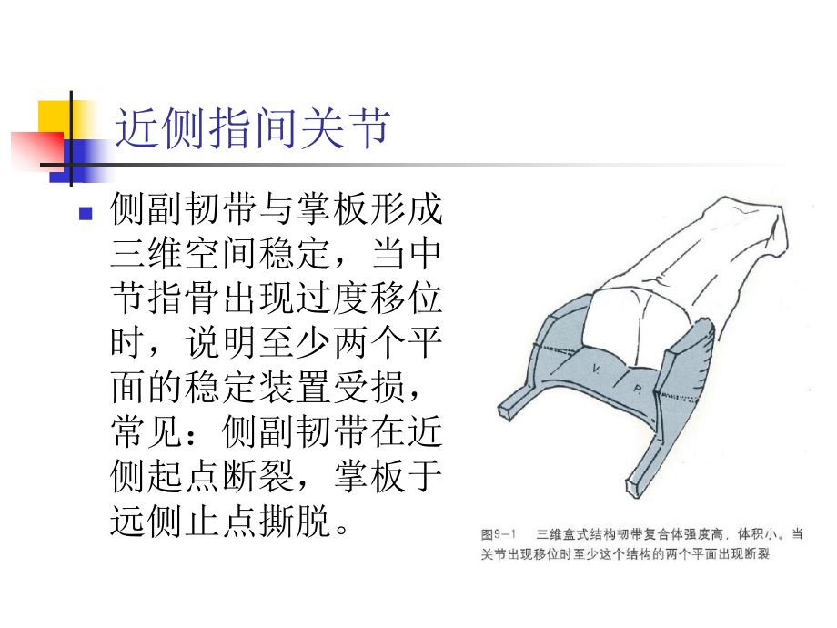 指间关节脱位及韧带损伤课件.ppt_第3页