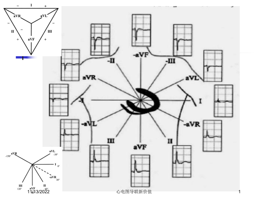 心电图导联新价值课件.ppt_第1页