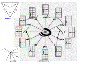 心电图导联新价值课件.ppt