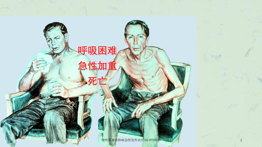 慢性阻塞性肺病急性发作治疗AECOPD课件.ppt_第2页