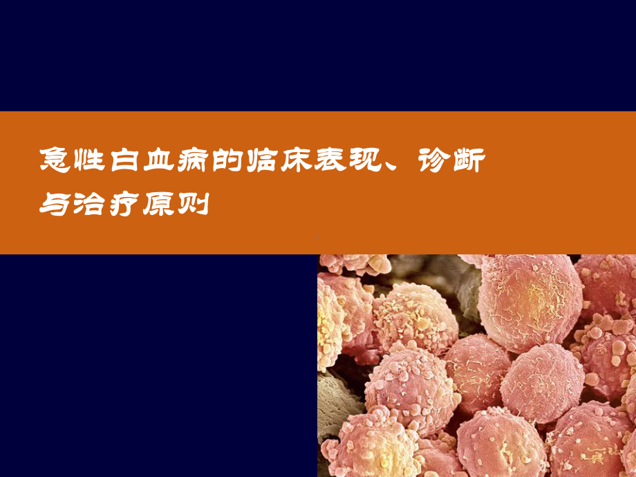 急性白血病的诊断与治疗医学课件.ppt_第1页