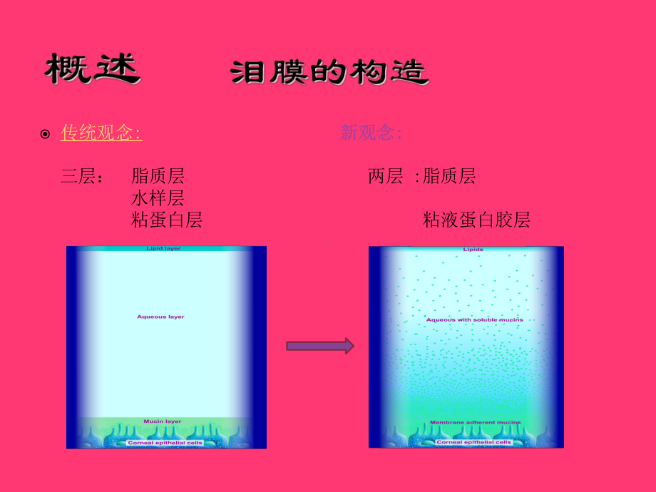 干眼症专业医学知识宣讲讲义课件.ppt_第3页