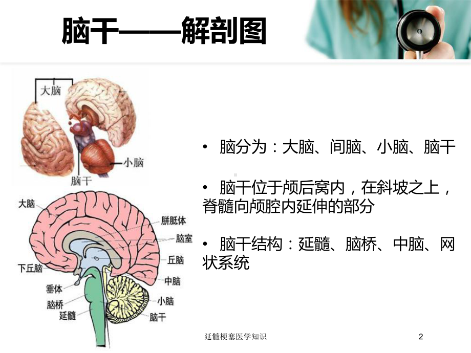 延髓梗塞医学知识培训课件.ppt_第2页