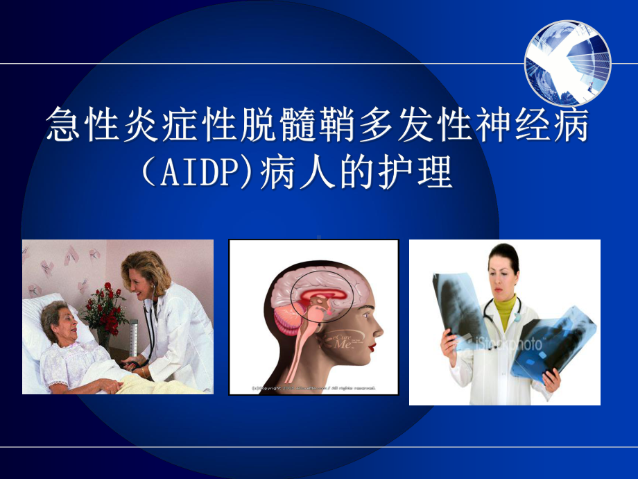 急性炎症性脱髓鞘多发性神经病(AIDP)病人的护理课件.pptx_第1页