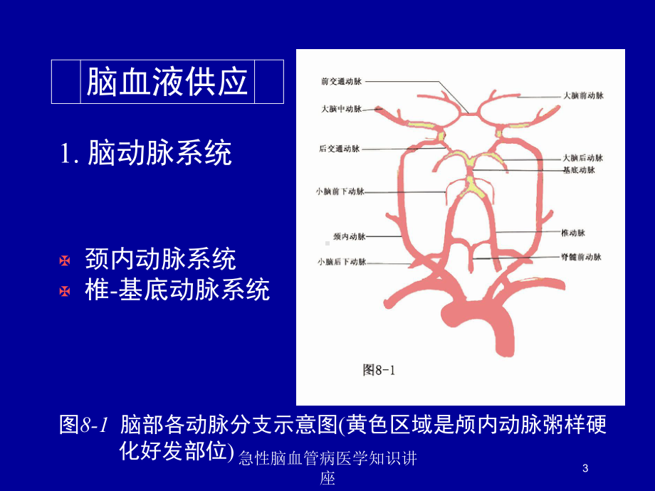 急性脑血管病医学知识讲座培训课件.ppt_第3页