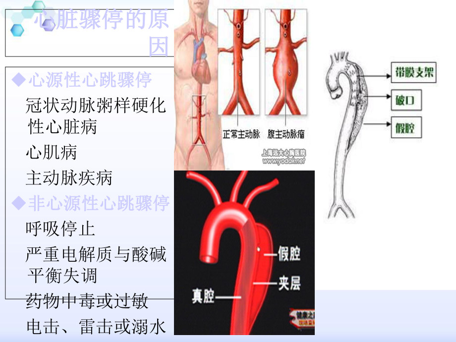 心脏骤停与心脑肺复苏最全课件.ppt_第3页