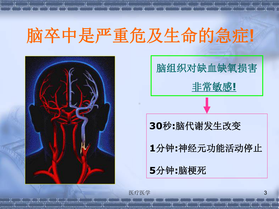 急性脑梗死静脉溶栓的护理(行业运用)课件.ppt_第3页