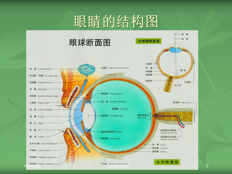 常见的眼部疾病培训课件.ppt_第3页