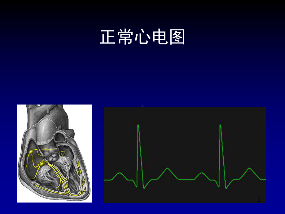 恶性心律失常的急诊药物治疗课件.ppt_第2页