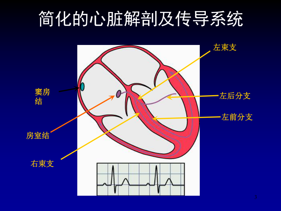 恶性心律失常的急诊药物治疗课件.ppt_第3页