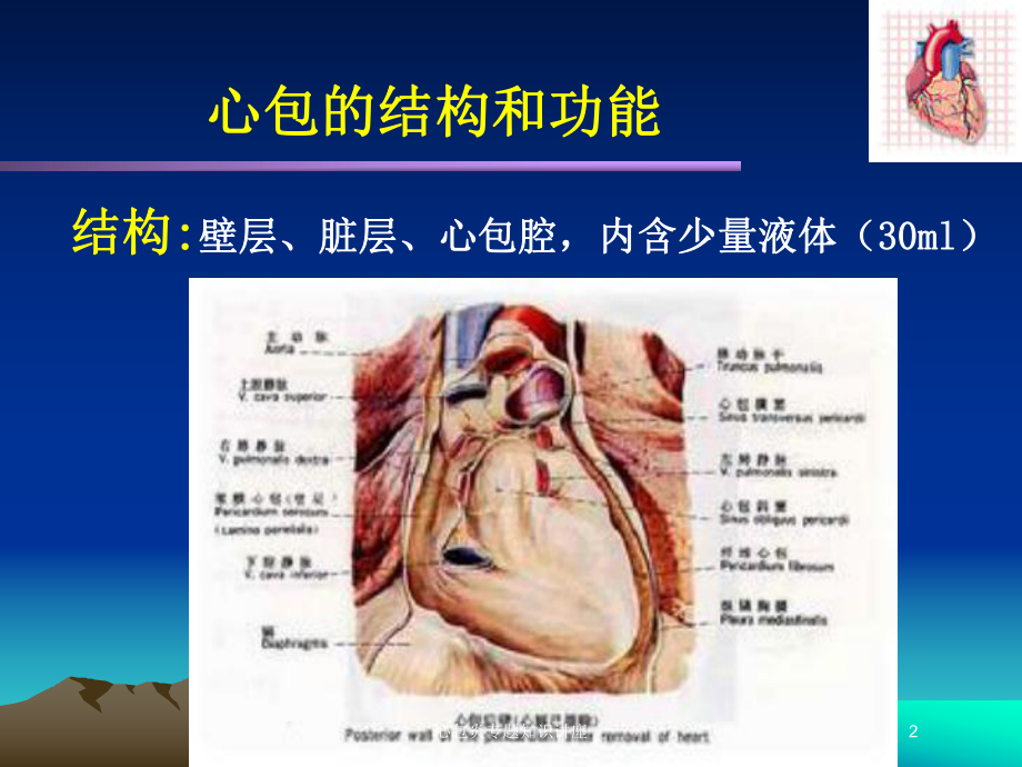 心包炎专题知识讲座培训课件.ppt_第2页