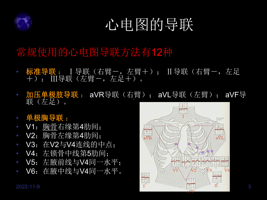 护士阅读心电图的能力培养教材课件.ppt_第3页