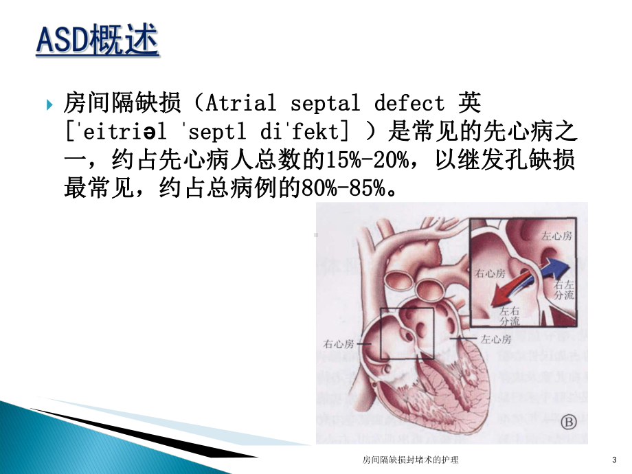 房间隔缺损封堵术的护理培训课件.ppt_第3页