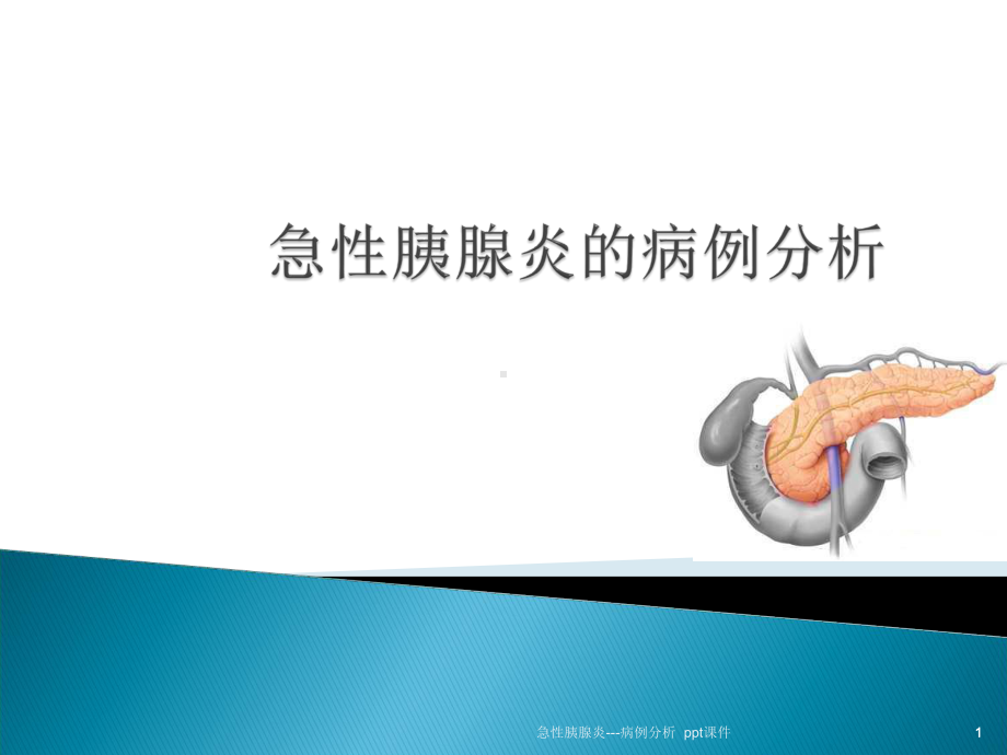 急性胰腺炎病例分析-课件.ppt_第1页