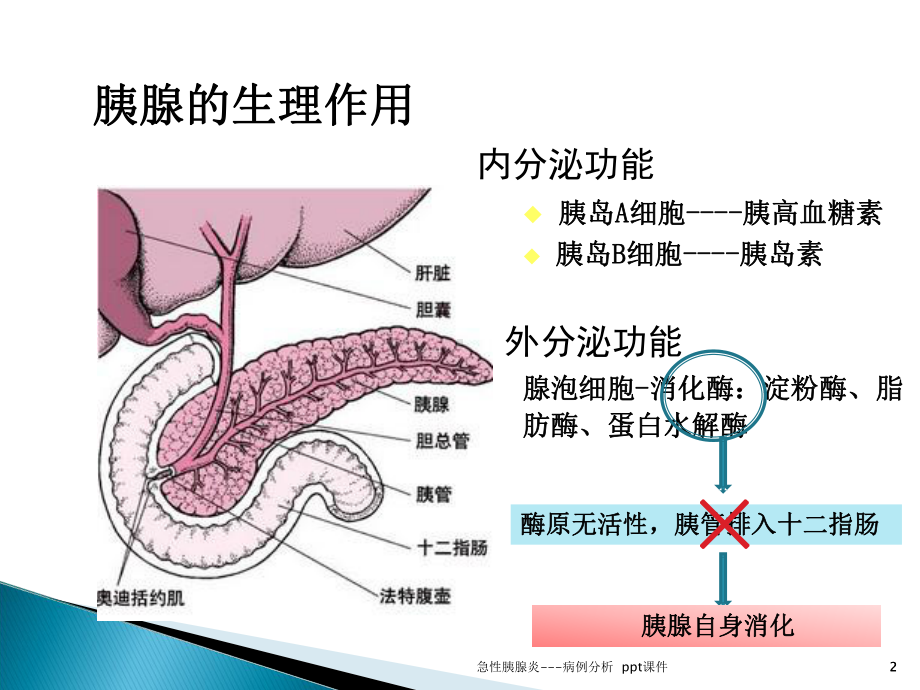 急性胰腺炎病例分析-课件.ppt_第2页