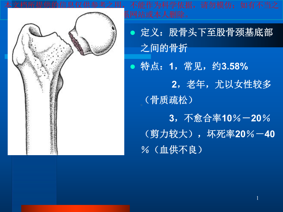 影像学股骨颈骨折培训课件.ppt_第1页