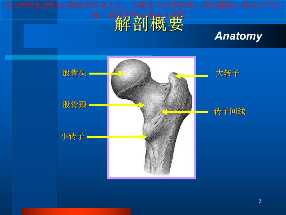 影像学股骨颈骨折培训课件.ppt_第3页