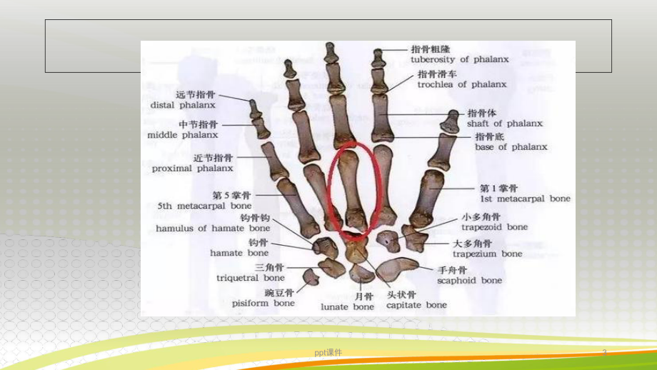 掌骨骨折的患者护理-课件.ppt_第3页