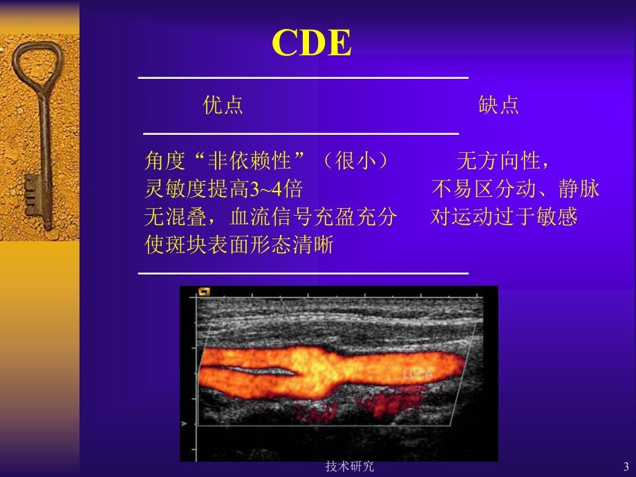 彩色多普勒超声在颈部血管的应用课件.ppt_第3页